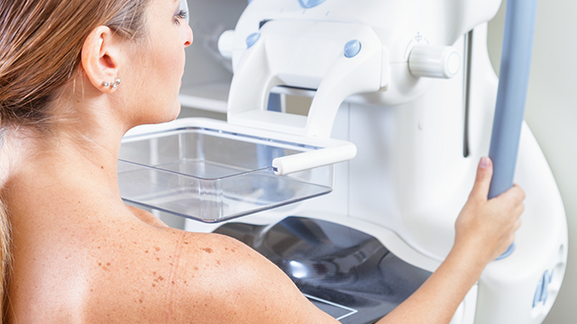 2D/3D Mammography, Density Assessment Software