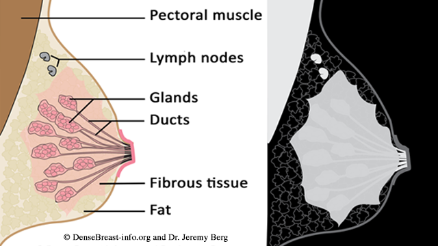Density Primer | Dense Breast Info