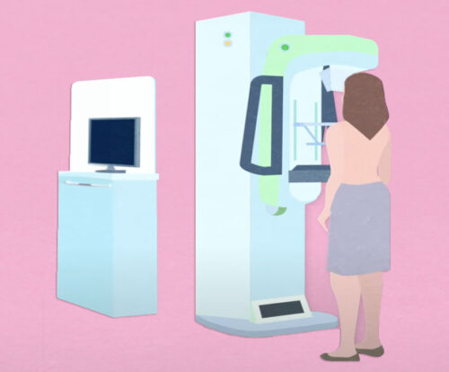 Screening Tests After A Mammogram Densebreast Info Inc