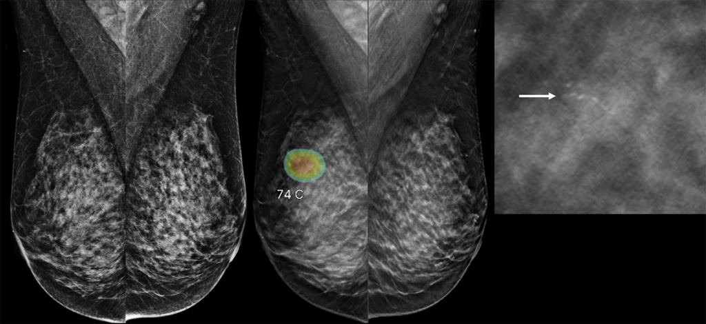 Mammographic images