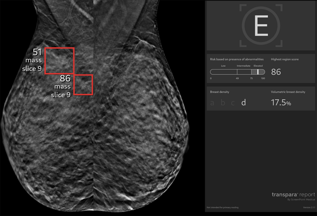 Mammographic images